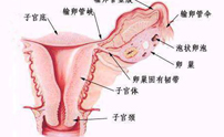 什么是附件炎?