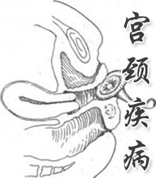 专家带你了解宫颈白斑的症状